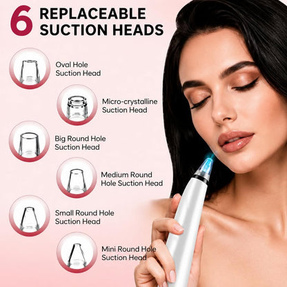 AquaGlow Blackhead Remover